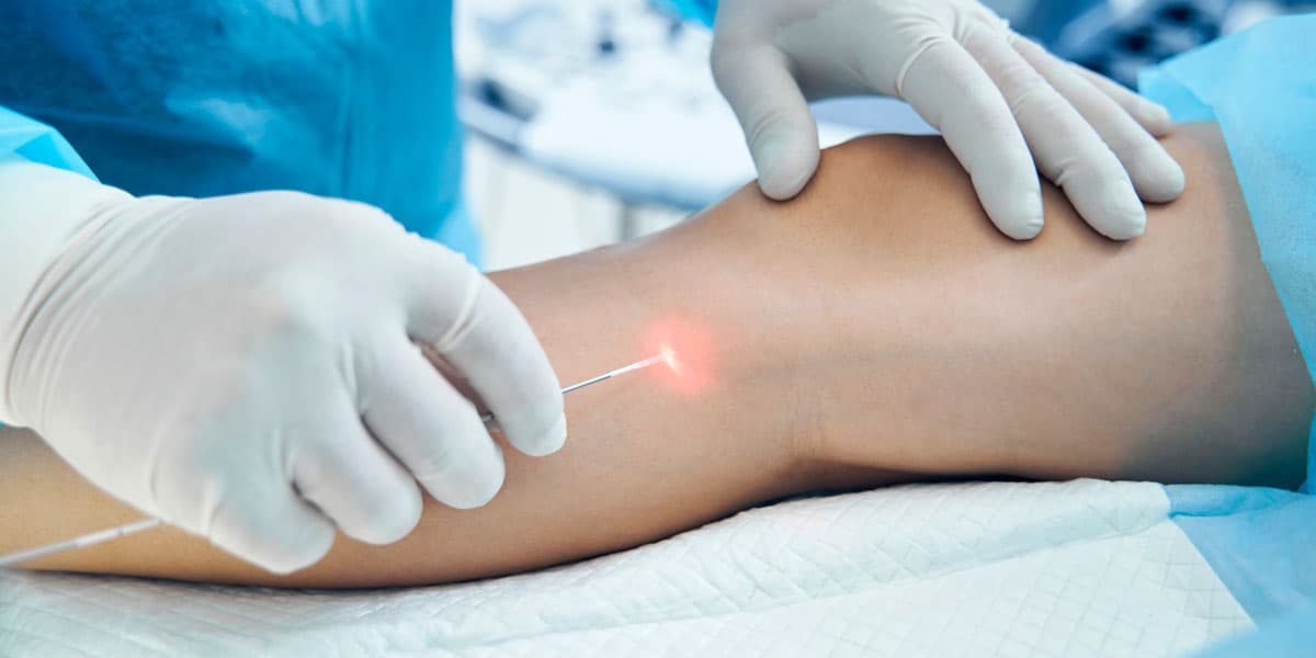 Doctor performing an endovenous laser treatment on a patient's leg.